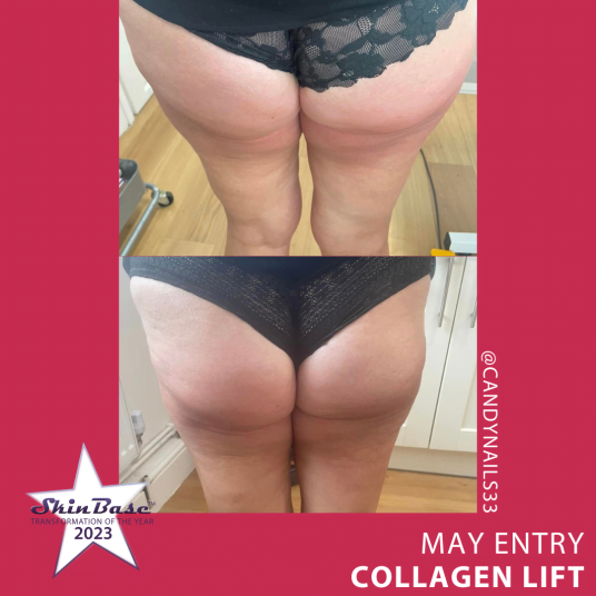 May Collagen Lift Entries